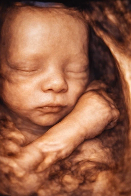 어흑흑.. 배가 불러 죽을거 가타여.._1.webp