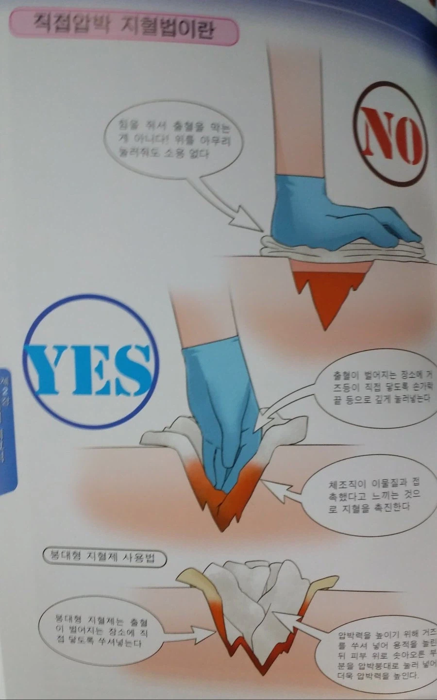 총상을 입었을때 제대로 지혈하는 방법.mp4_1.webp