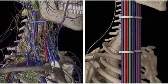 꼬인선 정리 초고수_1.webp