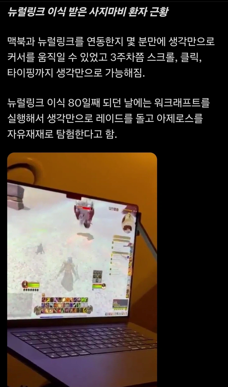 일론 머스크의 뉴럴링크 근황_1.webp