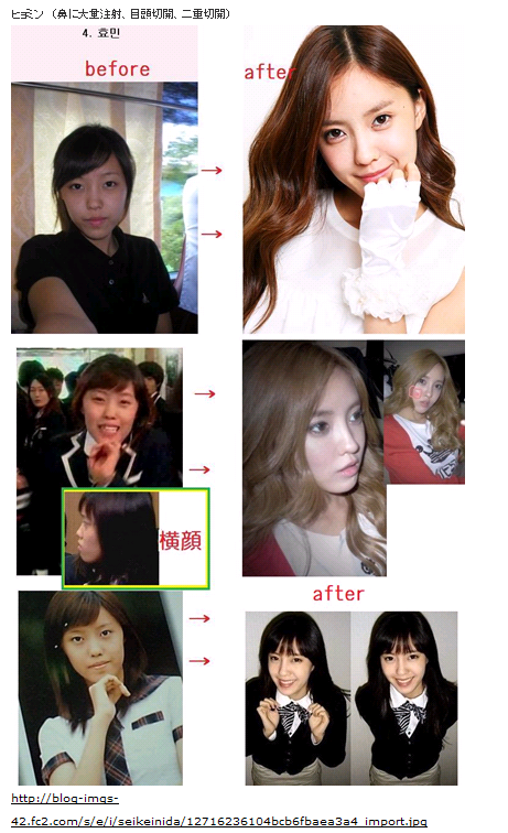 티아라 베스트앨범 앨범속 화영접한 일본현지 교민반응_10.jpg