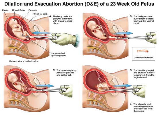 img/5/0/E/4/50E445894D48420027