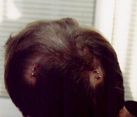 img/5/1/0/D/510D0784357BCC0027