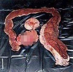 [혐짤주의] 똥참으면.._2.jpg