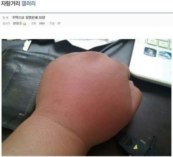 도라에몽 손 짤로 유명한 사람 근황.JPG_1.webp