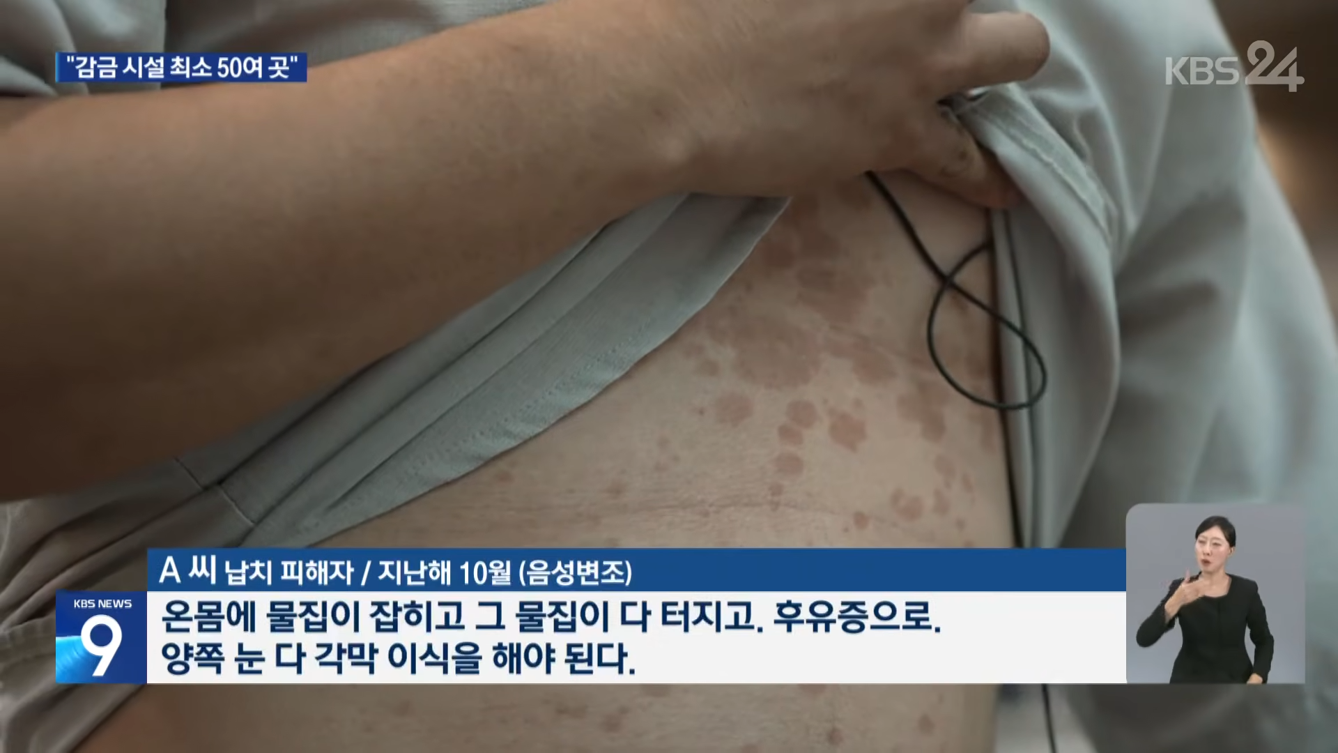 현재 캄보디아에서 벌어지고 있는 일_10.png